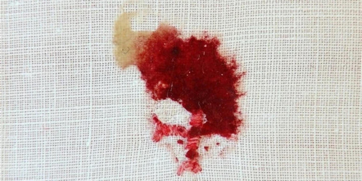 BLEEDING HOST