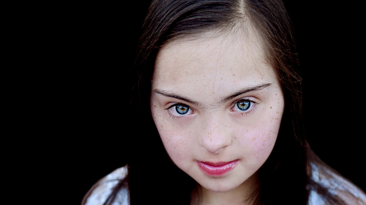WEB DOWN SYNDROME GIRL SMILE EYES Fot. Rivka Singer