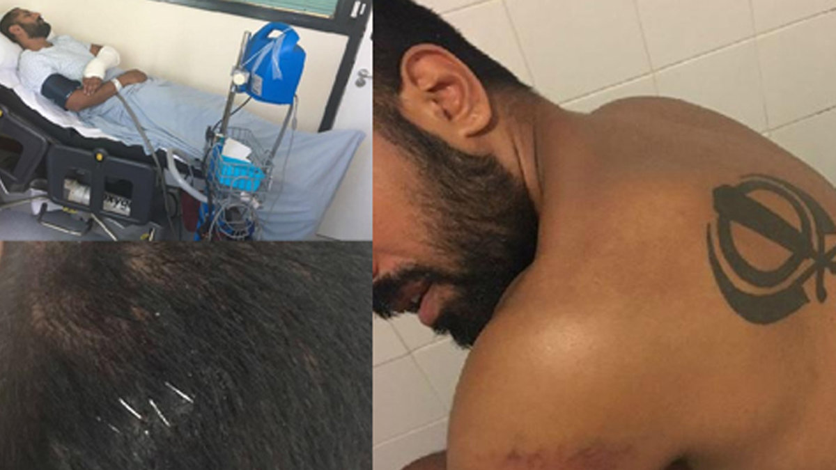 WEB3_AMO_SINGH_WOUNDS