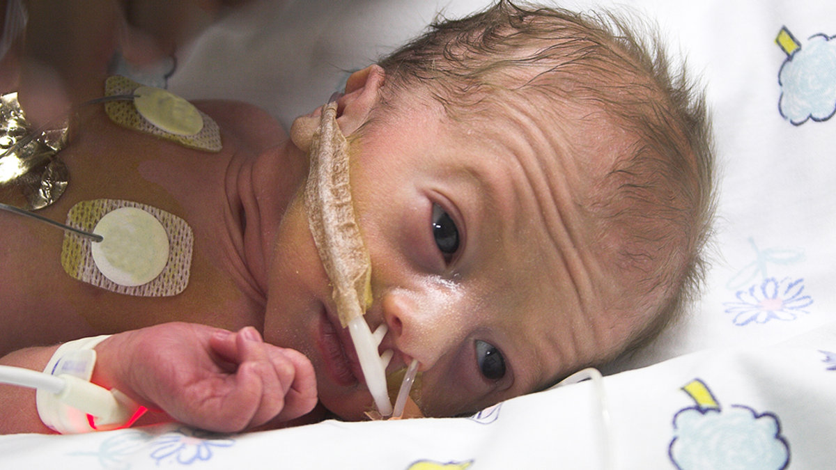 WEB3-PREMATURE-BABY-INFANT-ICU-HOSPITAL-shutterstock_3224706-Shutterstock