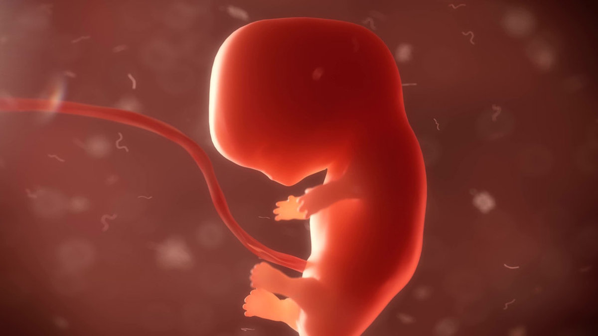 Aborto