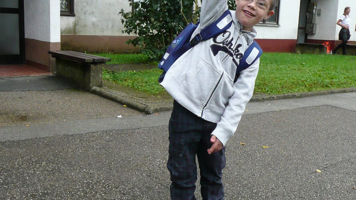 DOWN SYNDROME