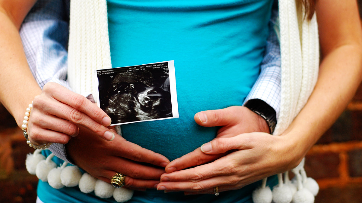 BABY;SONOGRAM