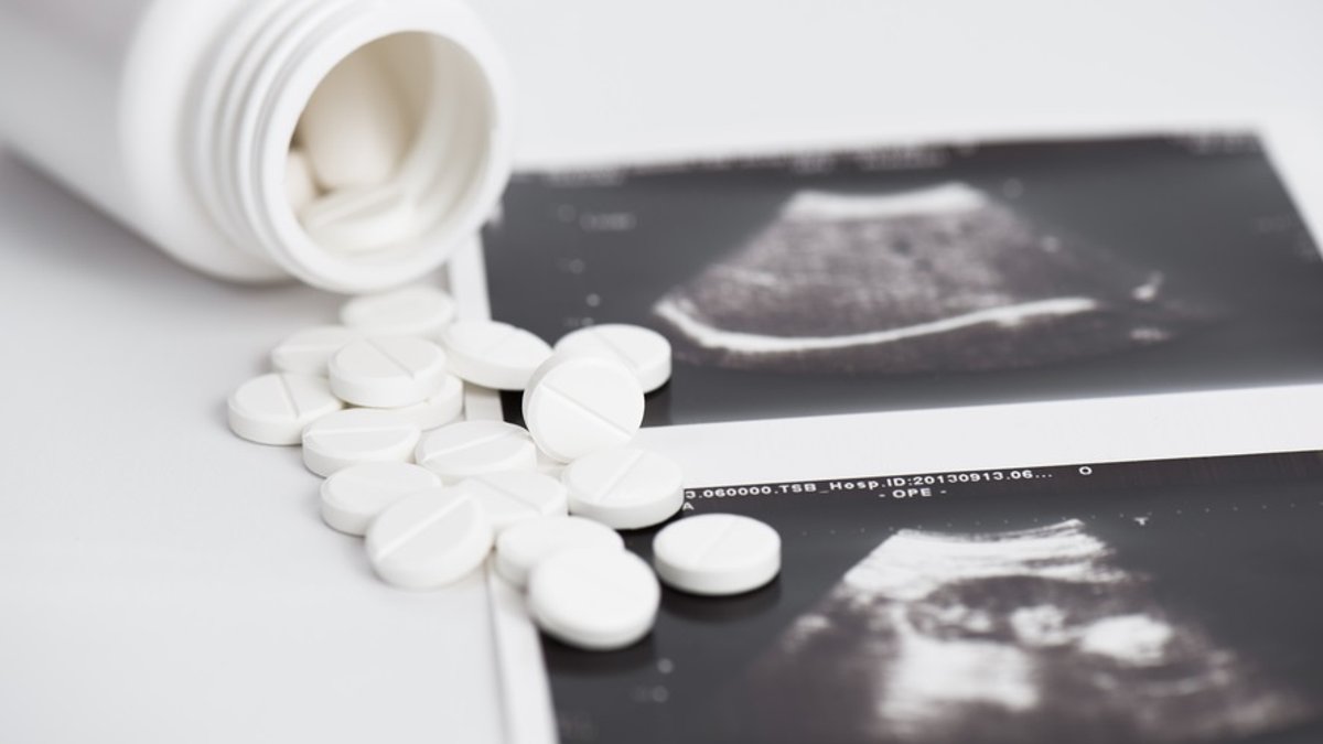 web3-abortion-pills-sonogram-shutterstock-ivanko89.jpg