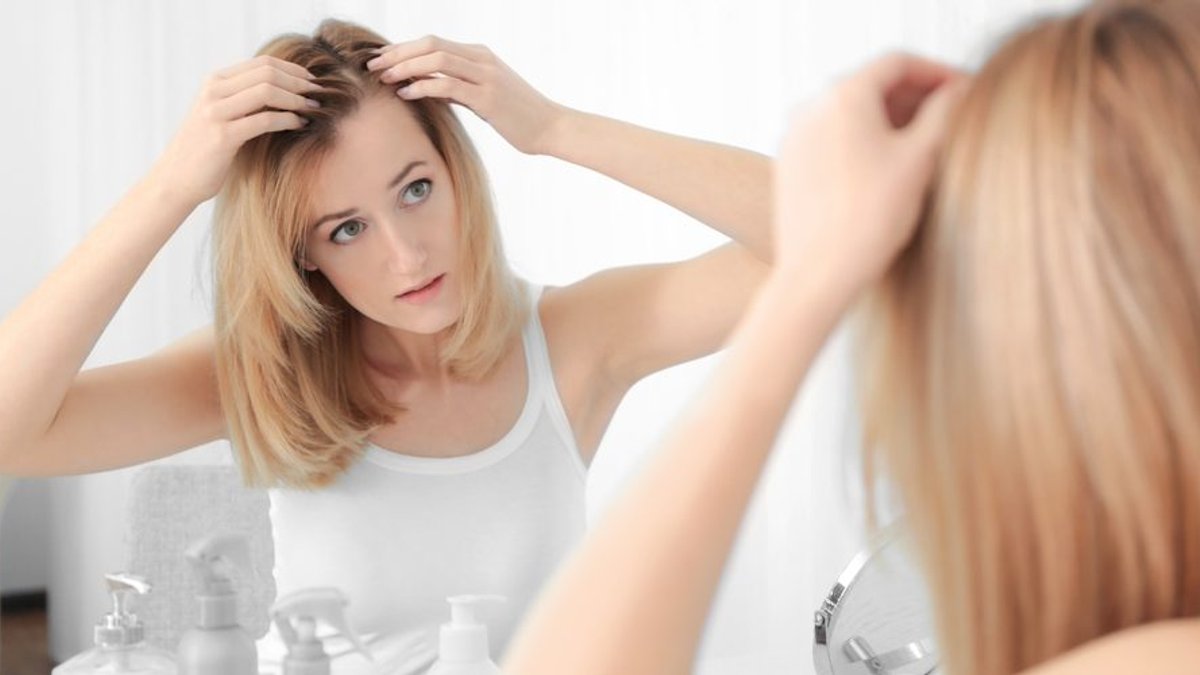 WOMAN-HAIR-LOSS
