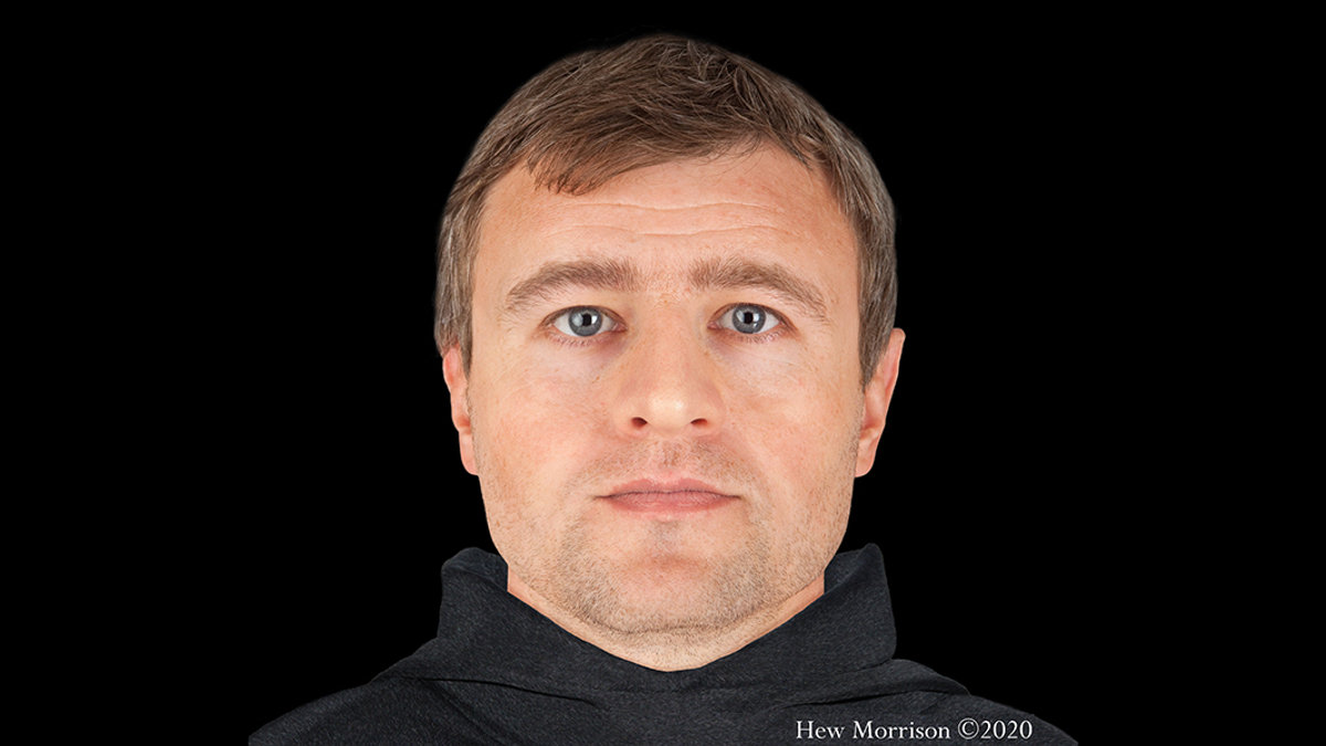 FORENSIC FACIAL RECONSTRUCTION