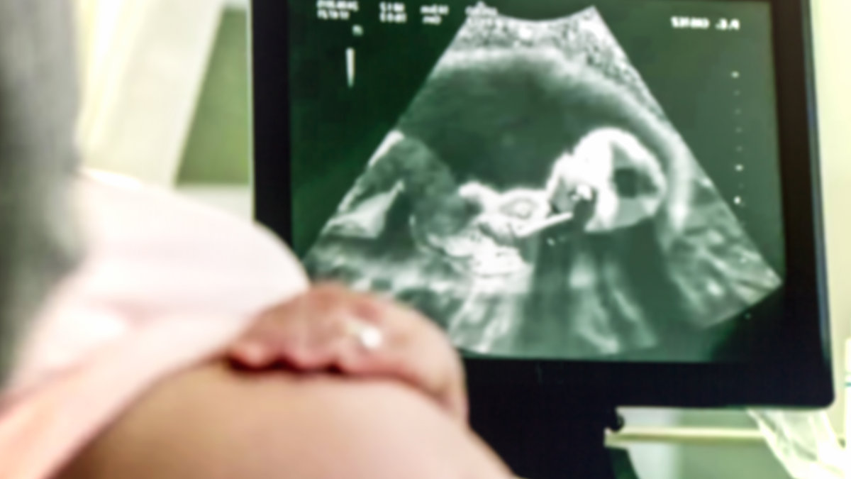 PREGNANT, ECOGRAPHY