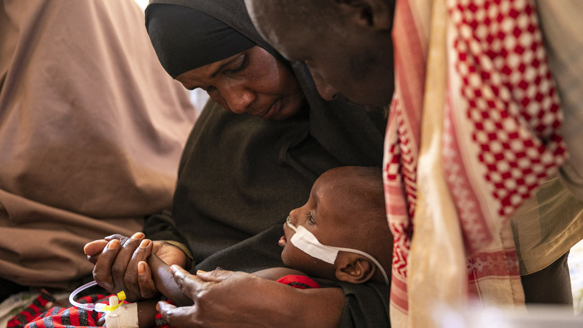 SOMALIA CHILD HUNGRY