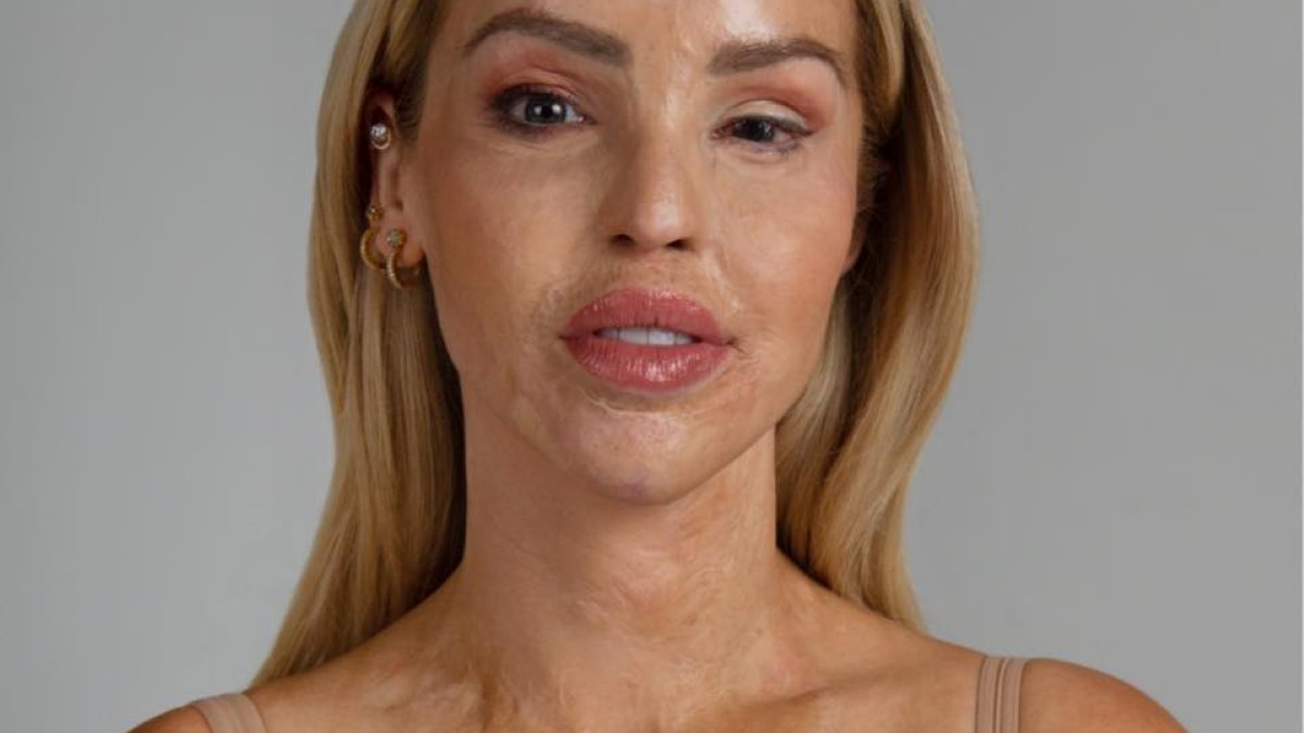 Katie Piper
