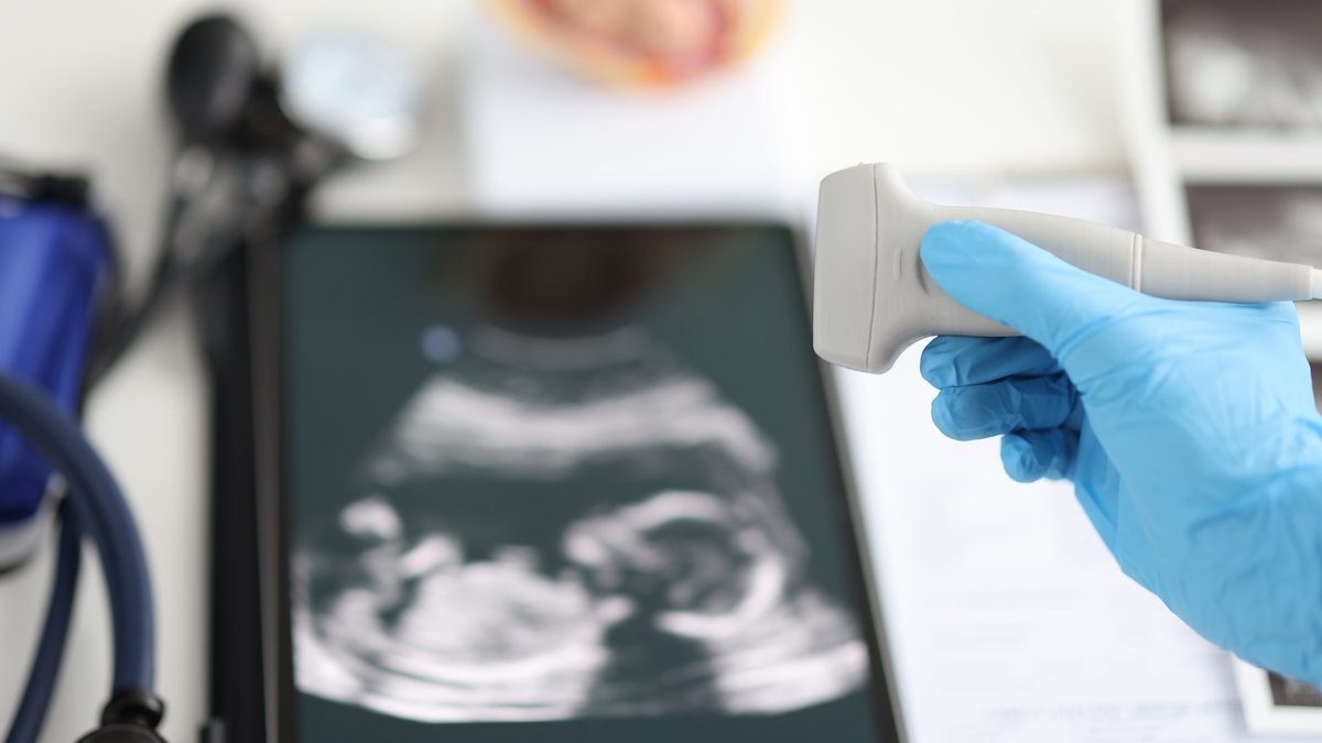 aborto