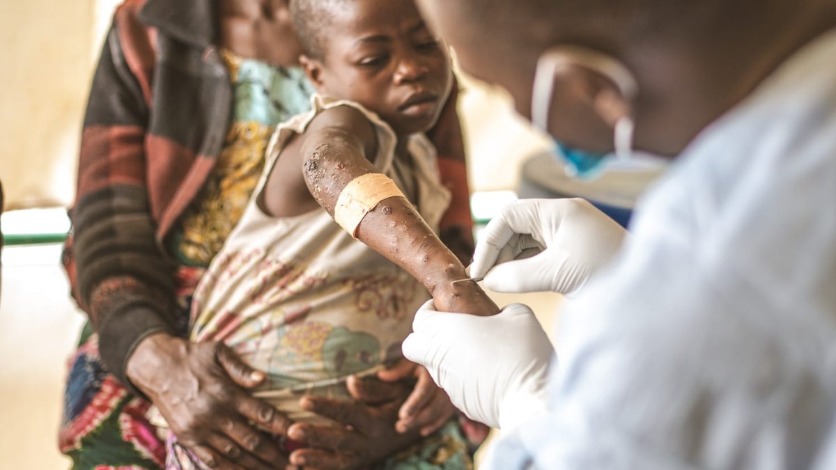 MEDAIRE-LUTTE-MPOX