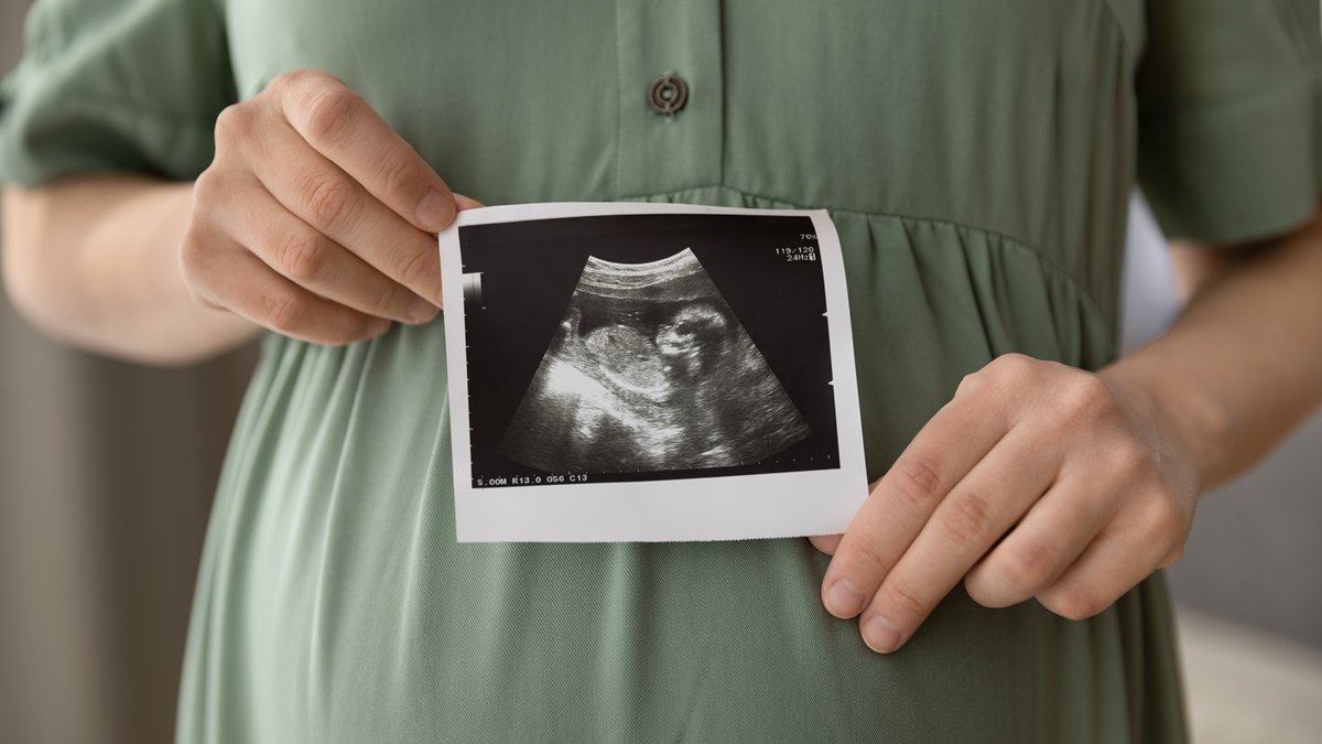 pregnancy ultrasound