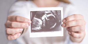 Pope backs “spiritual adoption of the unborn”