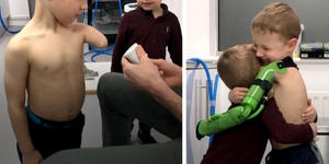5-year-old boy hugs brother for the first time when he gets a prosthetic arm