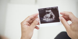 Ils ont découvert le handicap de leur bébé pendant la grossesse