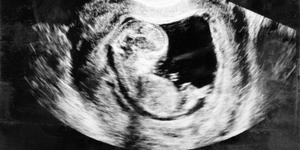 Why abortion can’t be supported by a scientific argument
