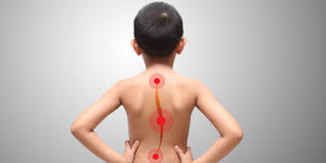 L’uso del corsetto per curare la scoliosi nei bambini