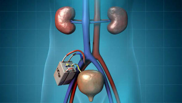 KIDNEY