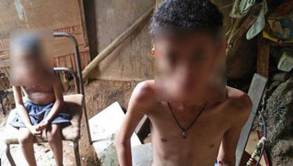 MALNUTRITION