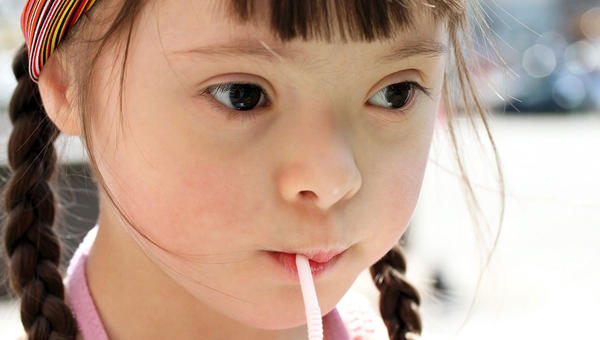 DOWN SYNDROME