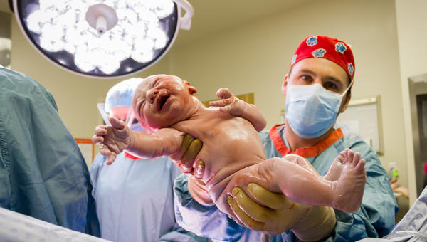 CESAREO NEWBORN