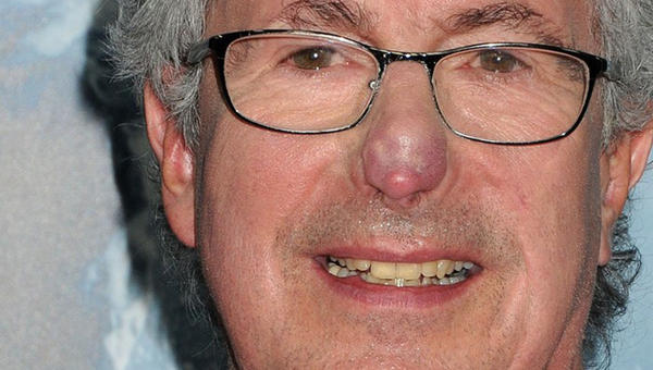 BECK WEATHERS