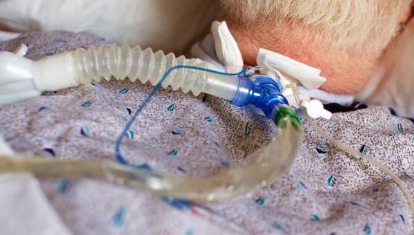 VENTILATOR, TRACHEOSTOMY,