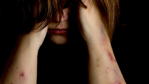 SELF-HARM,