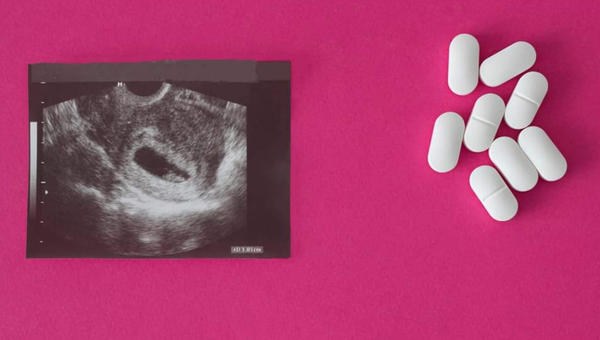 Aborto