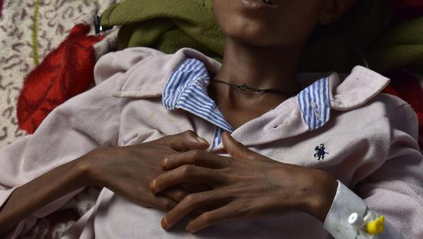 Ethiopia starvation