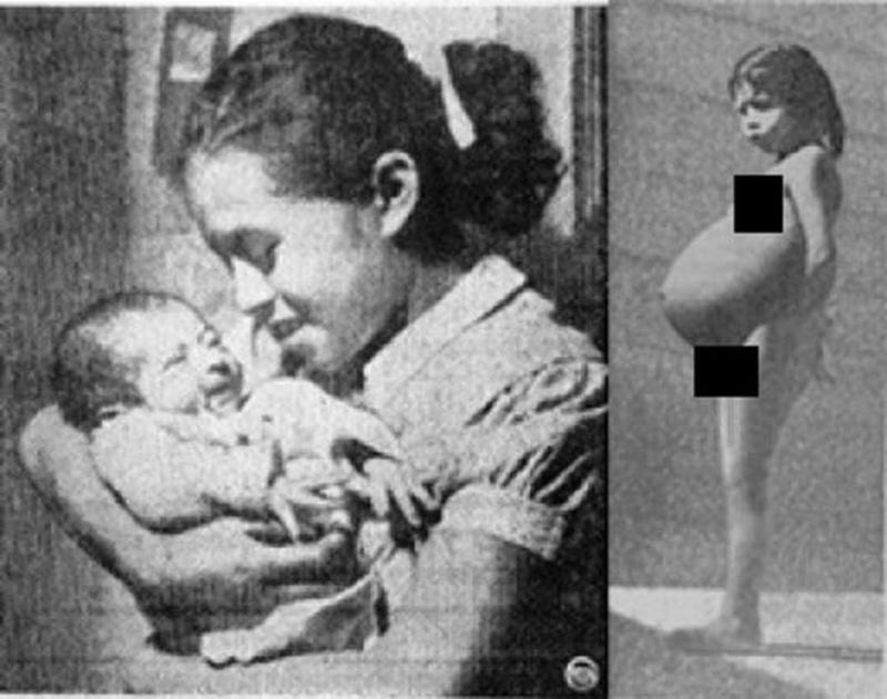 Lina Medina 3