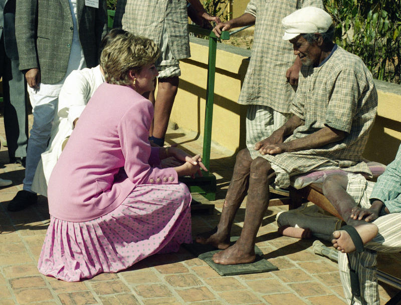 DIANA SPENCER LEPROSY