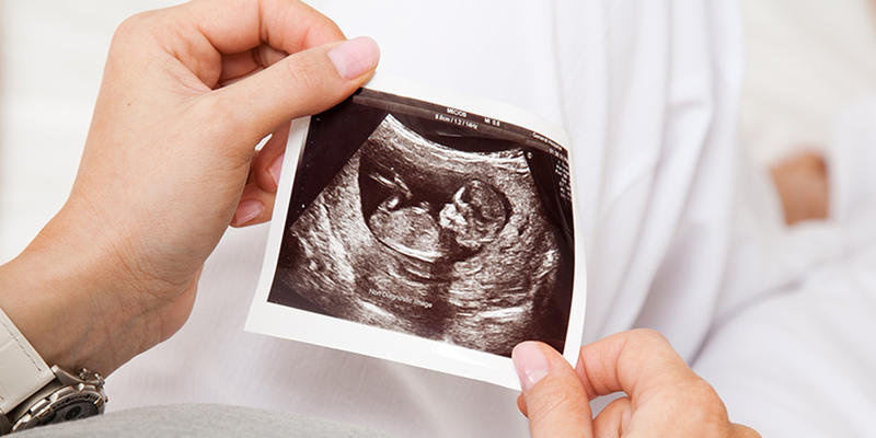 Ultrasound Sonogram