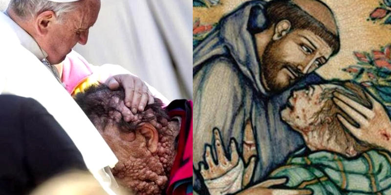 Papa Francisco abraça Vinicio; São Francisco abraça um leproso