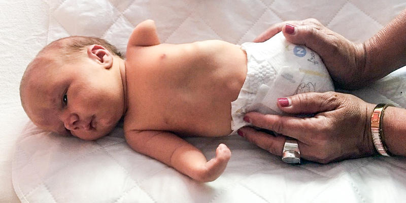 Baby Forrest without Limbs