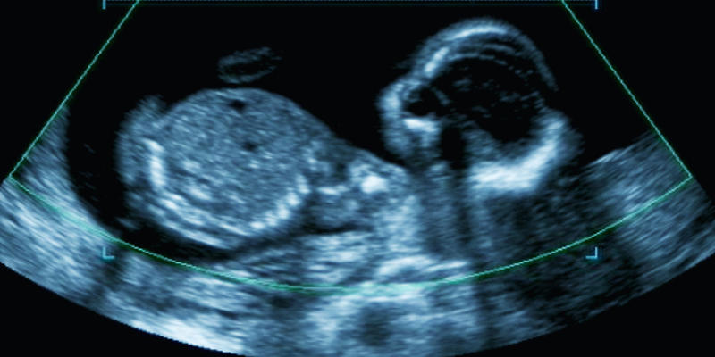 BABY ULTRASOUND
