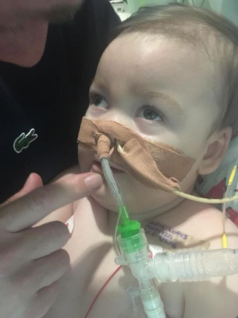 Alfie Evans de olhos abertos