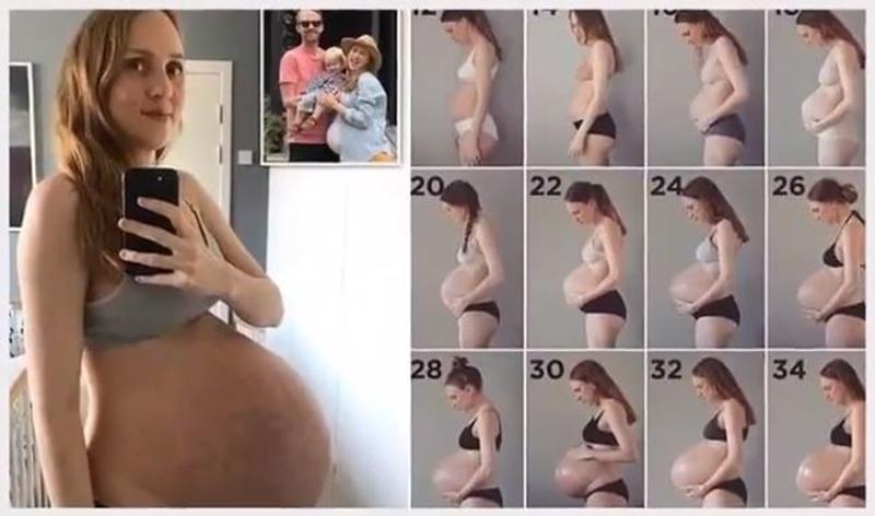 WOMAN WITH TRIPLETS