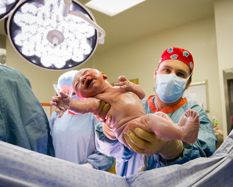 CESAREO NEWBORN