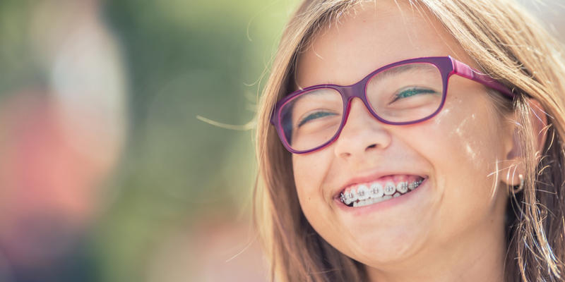 DENTAL BRACES