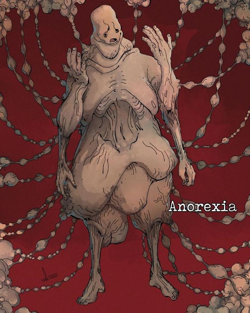ANOREXIA