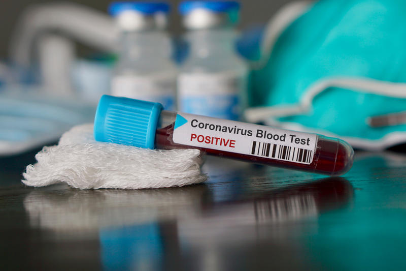 CORONAVIRUS TEST