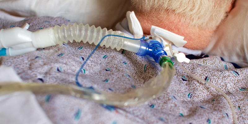 VENTILATOR, TRACHEOSTOMY,