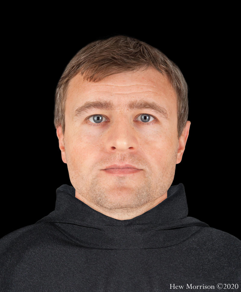 FORENSIC FACIAL RECONSTRUCTION
