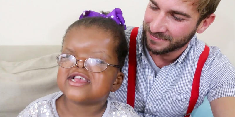 LOLA'S LIFE WITH APERT SYNDROME